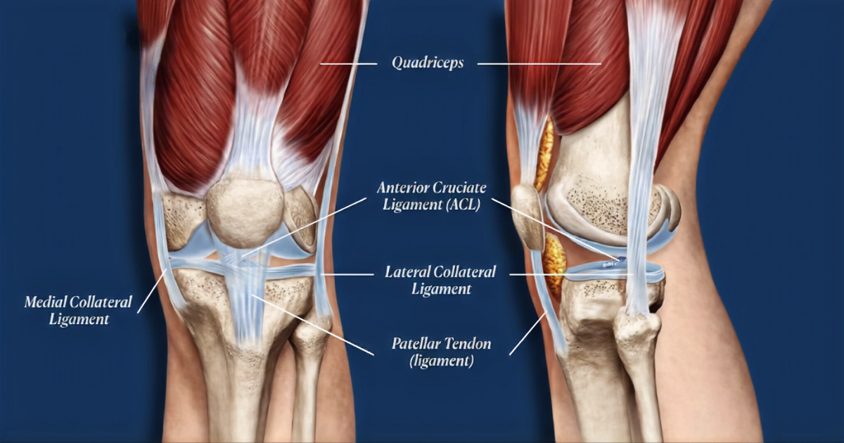 Knee sprain treatment anatomy diagram labelling the ACL, medial and lateral collateral ligaments, quadriceps, and patellar tendon